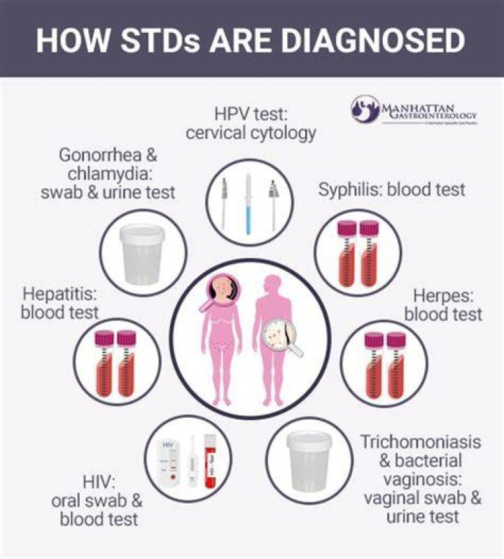 How do doctors check if you have STDs?