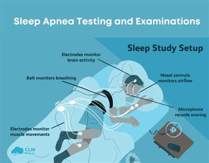 What is a diagnostic test for sleep apnea?